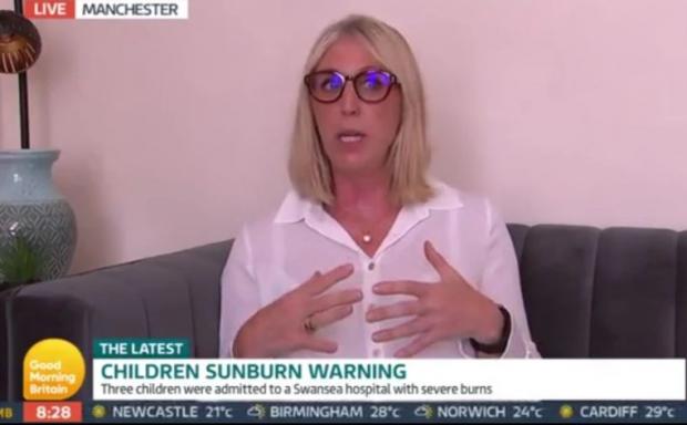 This Is Local London: Dr Sarah Carlick said sunburn is a matter of safe guarding