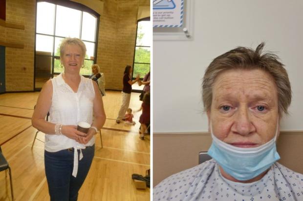 This Is Local London: Sharon before her condition and at hospital (Sharon Churchill)